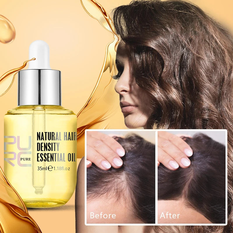 Traitement capillaire PURC – Huile anti-chute et croissance cheveux homme & femme