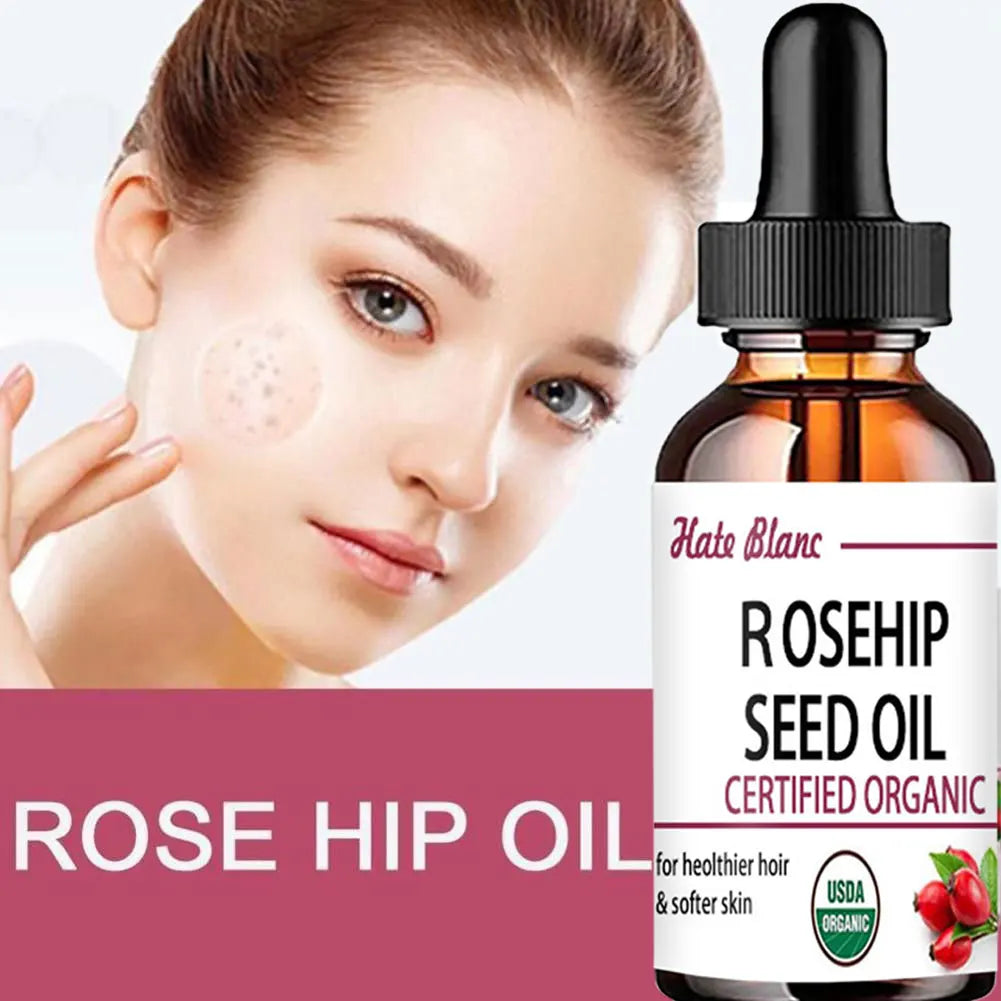 Huile de Rose Musquée hydratante – Soin peau, massage et éclat du teint