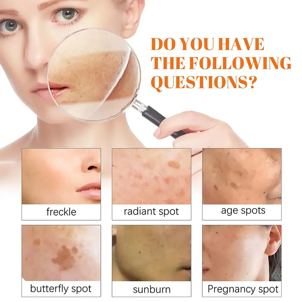 Huile de Rose Musquée hydratante – Soin peau, massage et éclat du teint