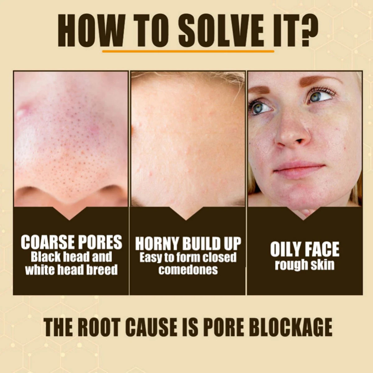 Huile de Rose Musquée hydratante – Soin peau, massage et éclat du teint