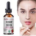 Huile de Rose Musquée hydratante – Soin peau, massage et éclat du teint
