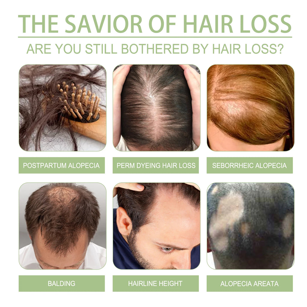 100ml Hair Growth Oil India Adivasi Herbal Hair Care Rosemary Repair Damaged Hydrate Moisturize Scalp Reduce Dandruff