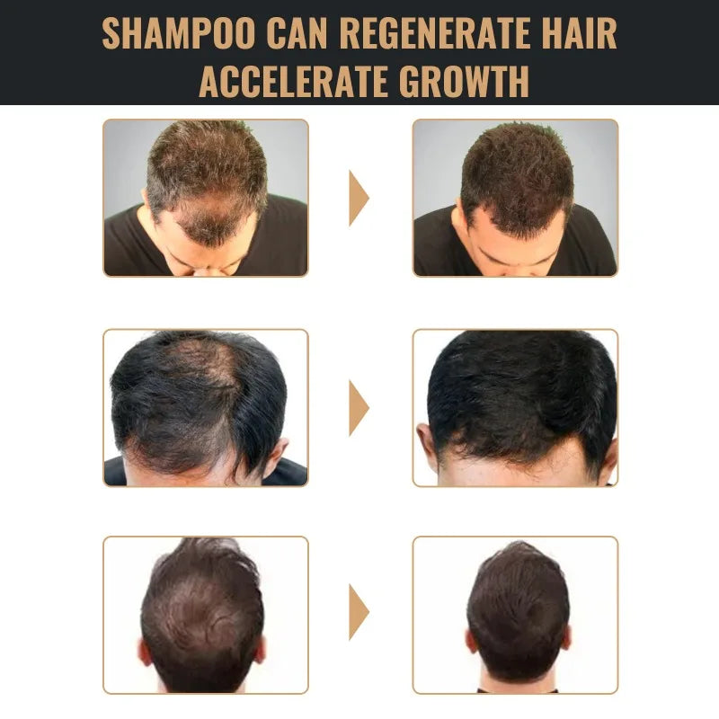 Shampooing anti-chute & épaississant – Renforce les racines et répare le cuir chevelu