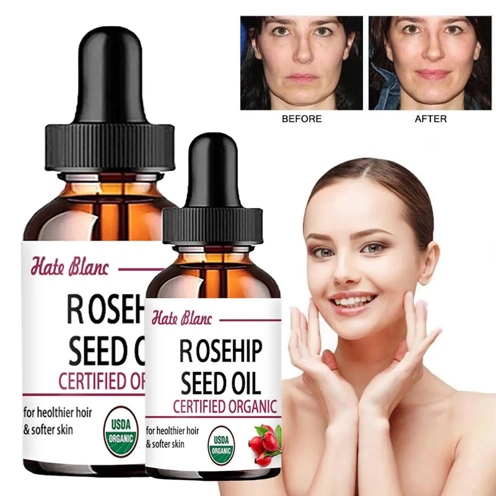 Huile de Rose Musquée hydratante – Soin peau, massage et éclat du teint