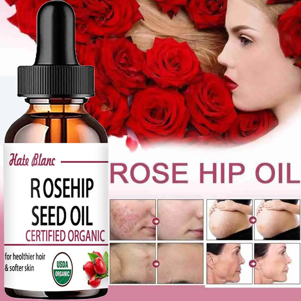 Huile de Rose Musquée hydratante – Soin peau, massage et éclat du teint
